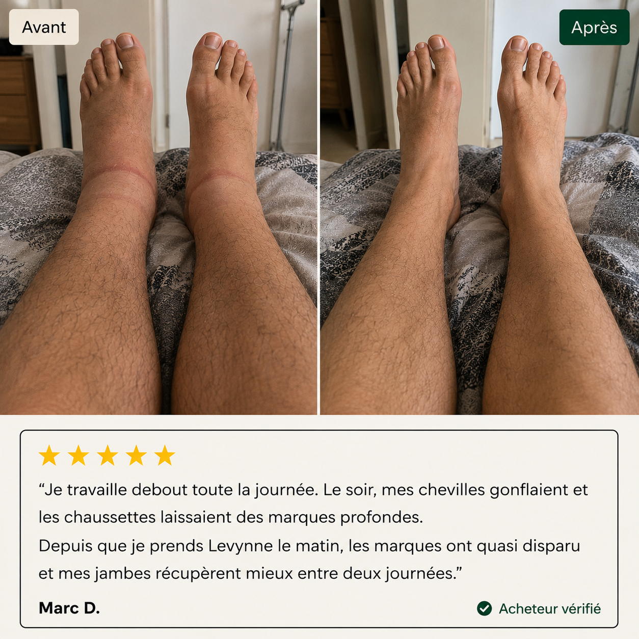 DRAINANT LYMPHATIQUE